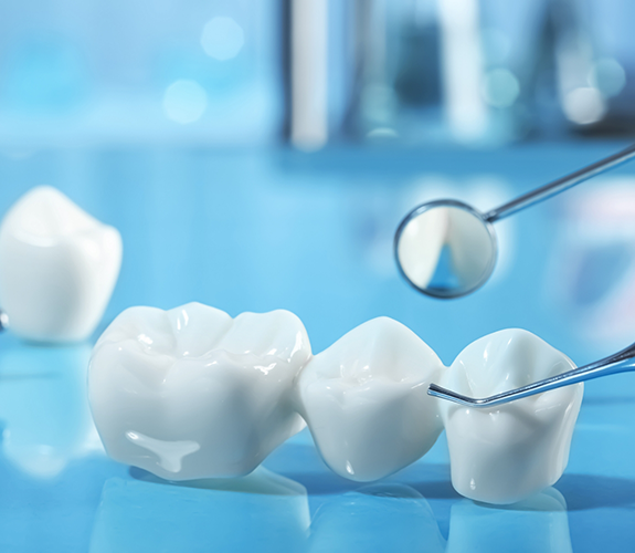 Dental bridge against a pale blue background