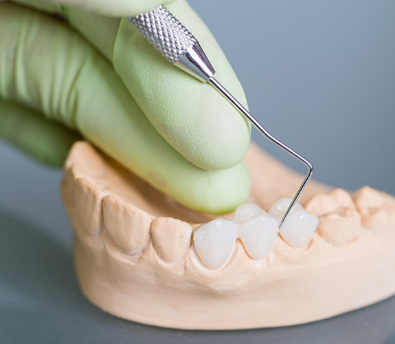 Dentist adjusting a dental bridge in a model of an arch of teeth