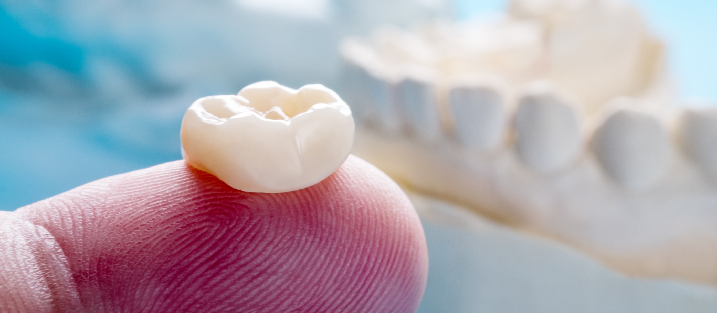 Close up of a dental crown resting on a finger