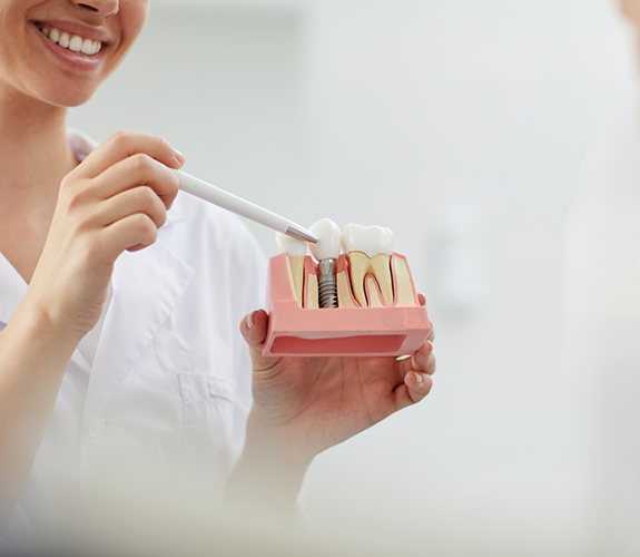 Dentist showing a model of a dental implant to a patient