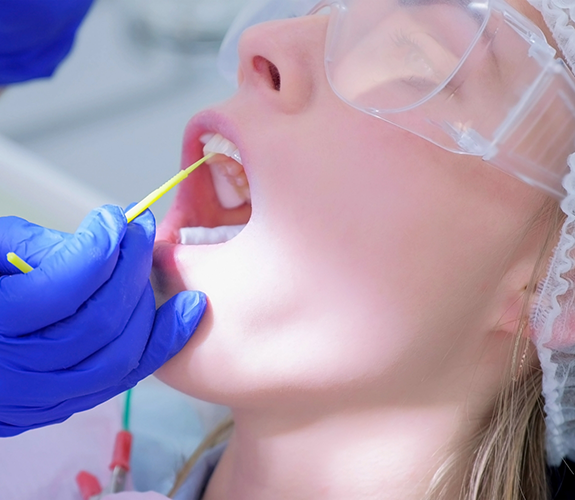 Close up of a dental patient having fluoride applied to their teeth