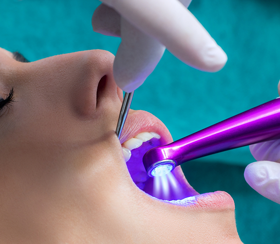 Close up of a dental patient receiving dental sealants on their teeth